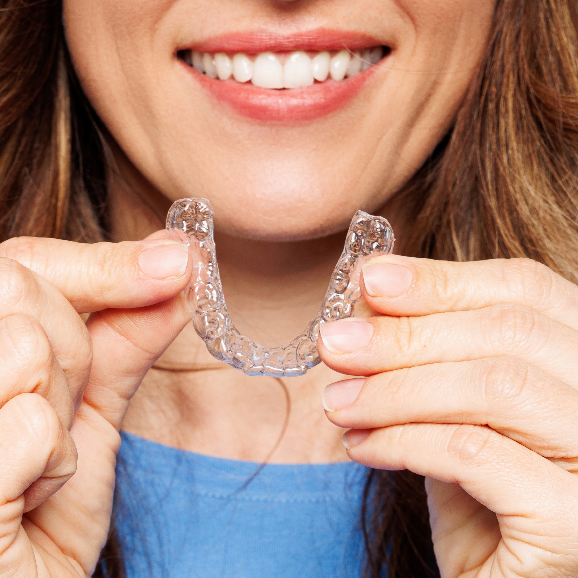 Clear aligner results Dubai