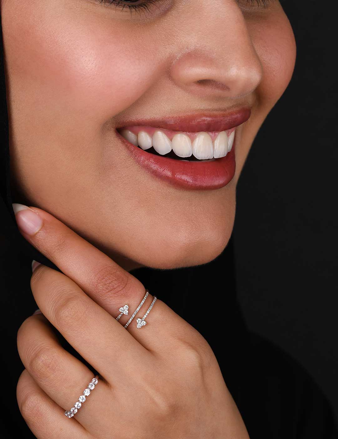 Harmony Medical Center female patient showcasing a beautiful, natural-looking smile after a smile makeover treatment.