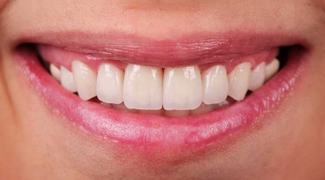 After Gum Treatment
