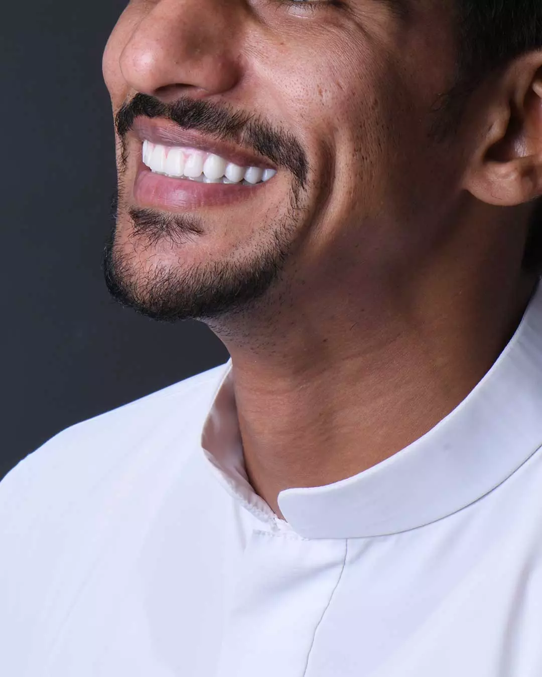 Close-up of the smile of an elderly Emirati patient at Harmony Medical Center after All-on-6 dental implant treatment.