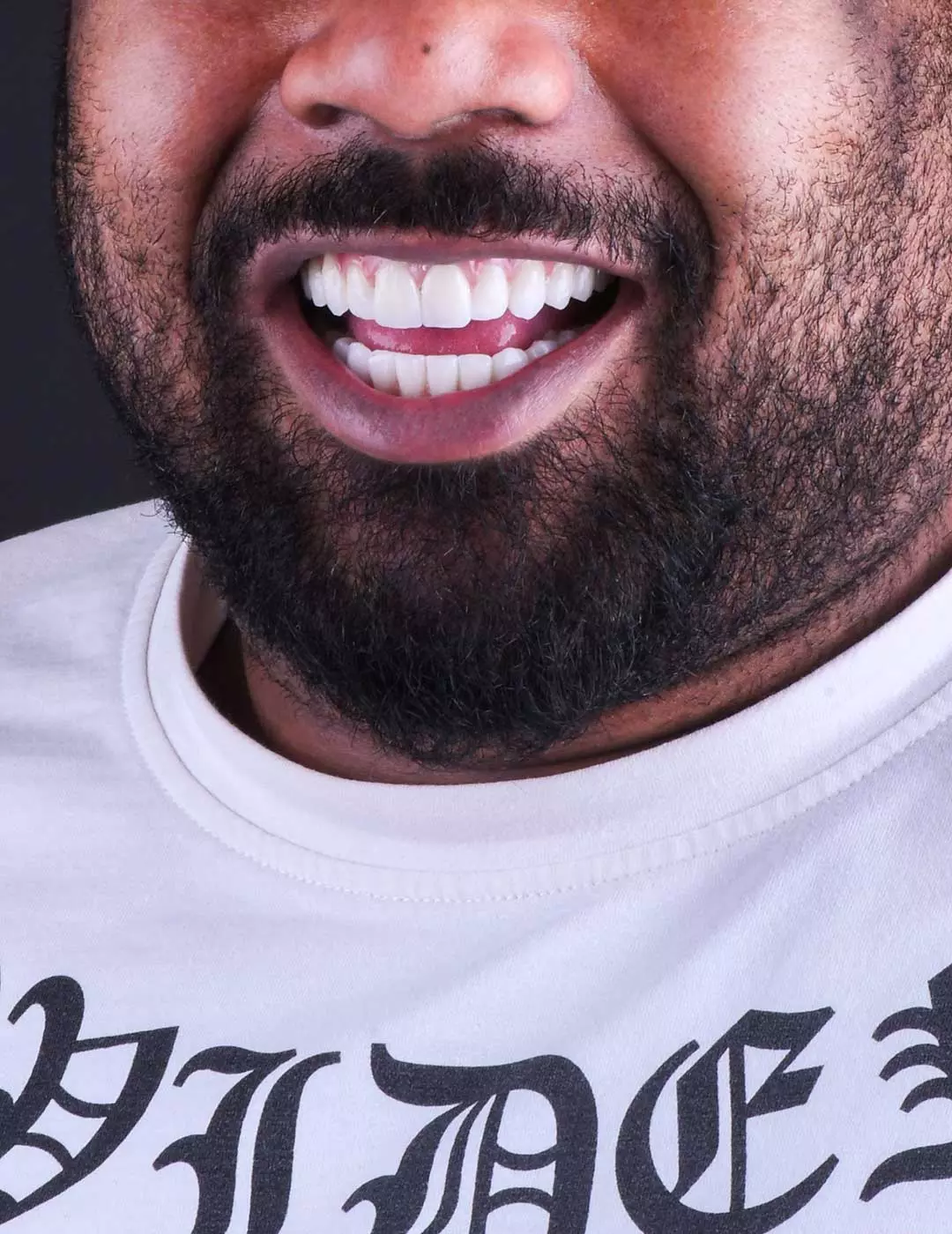 Photo of a man with a big beautiful smile after dental implants