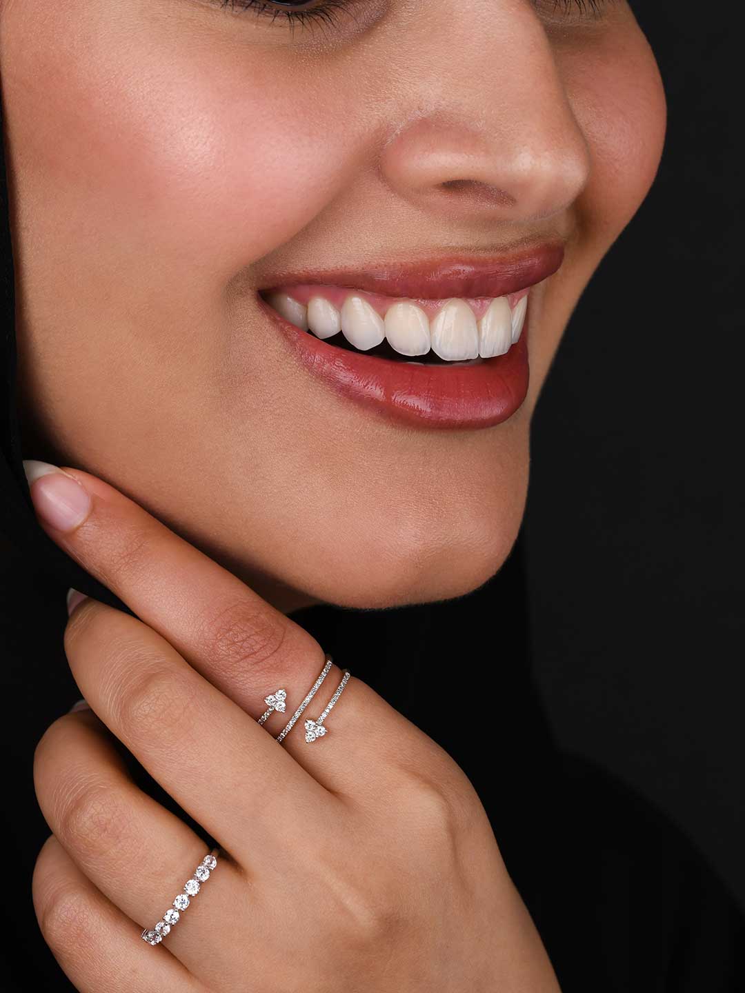 A photo showing half the face of a lady with beautiful natural looking porcelain veneers